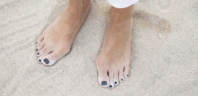 Hallux_Valgus_05_1348x599px